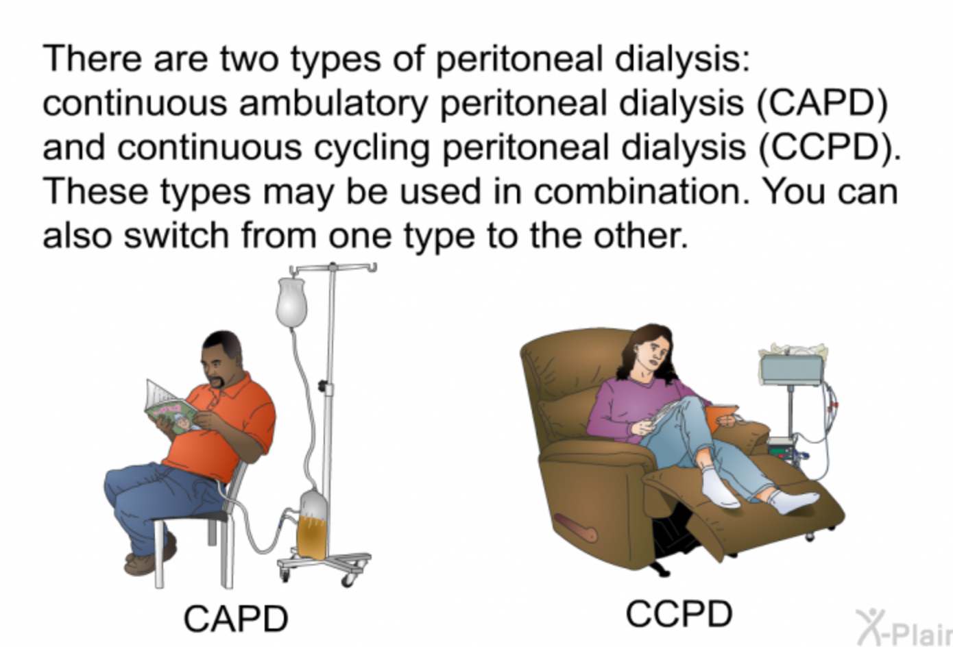 Continuous Ambulatory Peritoneal Dialysis (CAPD) A Convenient Treatment Option for Kidney Failure